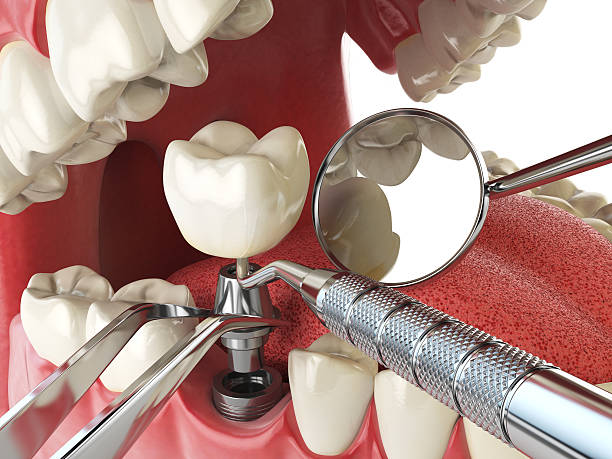 Best Emergency Cosmetic Dentistry in Bridgeview, IL
