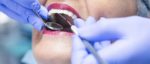 Best Broken or Cracked Tooth Emergency Dentist in Bridgeview, IL